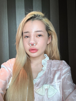 Hình ảnh tàn tạ khiến nhiều người giật mình của Ngân 98 tại thời điểm