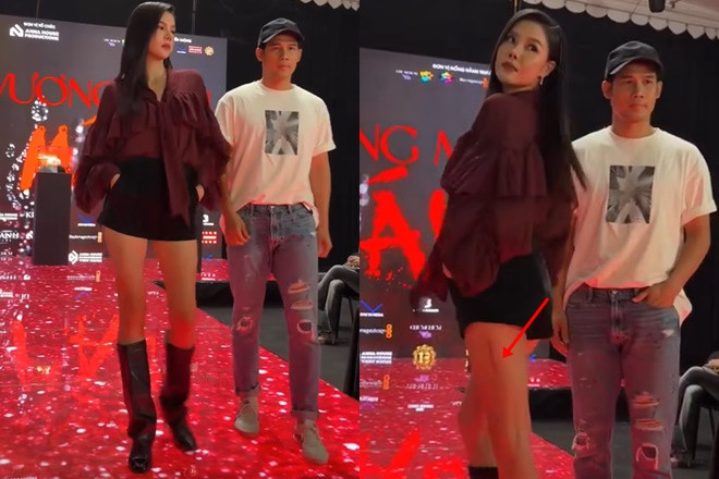 Vợ Mạc Hồng Quân catwalk trở lại sau 6 tháng gãy đùi bị soi đôi chân con rết kém thẩm mỹ