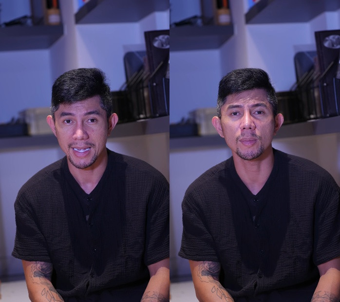 Lương Bằng Quang tiết lộ mũi Ngân 98 đang bị hoại tử