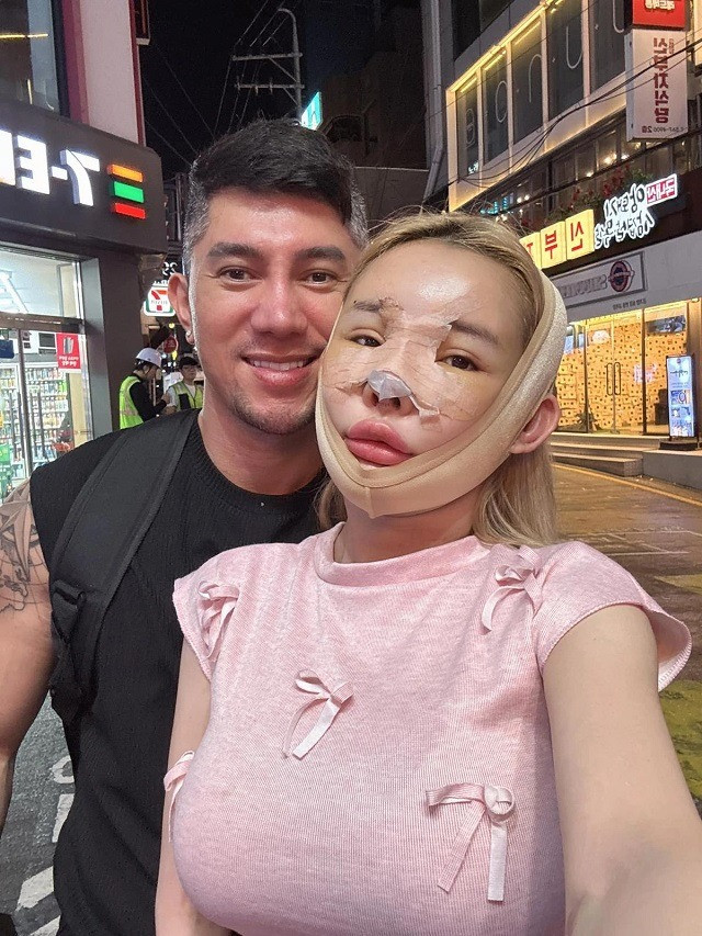 Lương Bằng Quang tiết lộ mũi Ngân 98 đang bị hoại tử