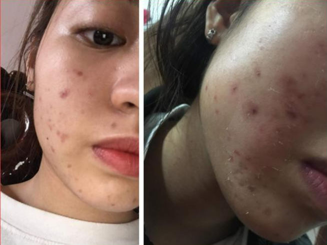 Hot girl Trứng rán cần mỡ sinh con đầu lòng mặt mộc ra sao sau nhiều lần lộ ảnh kém sắc