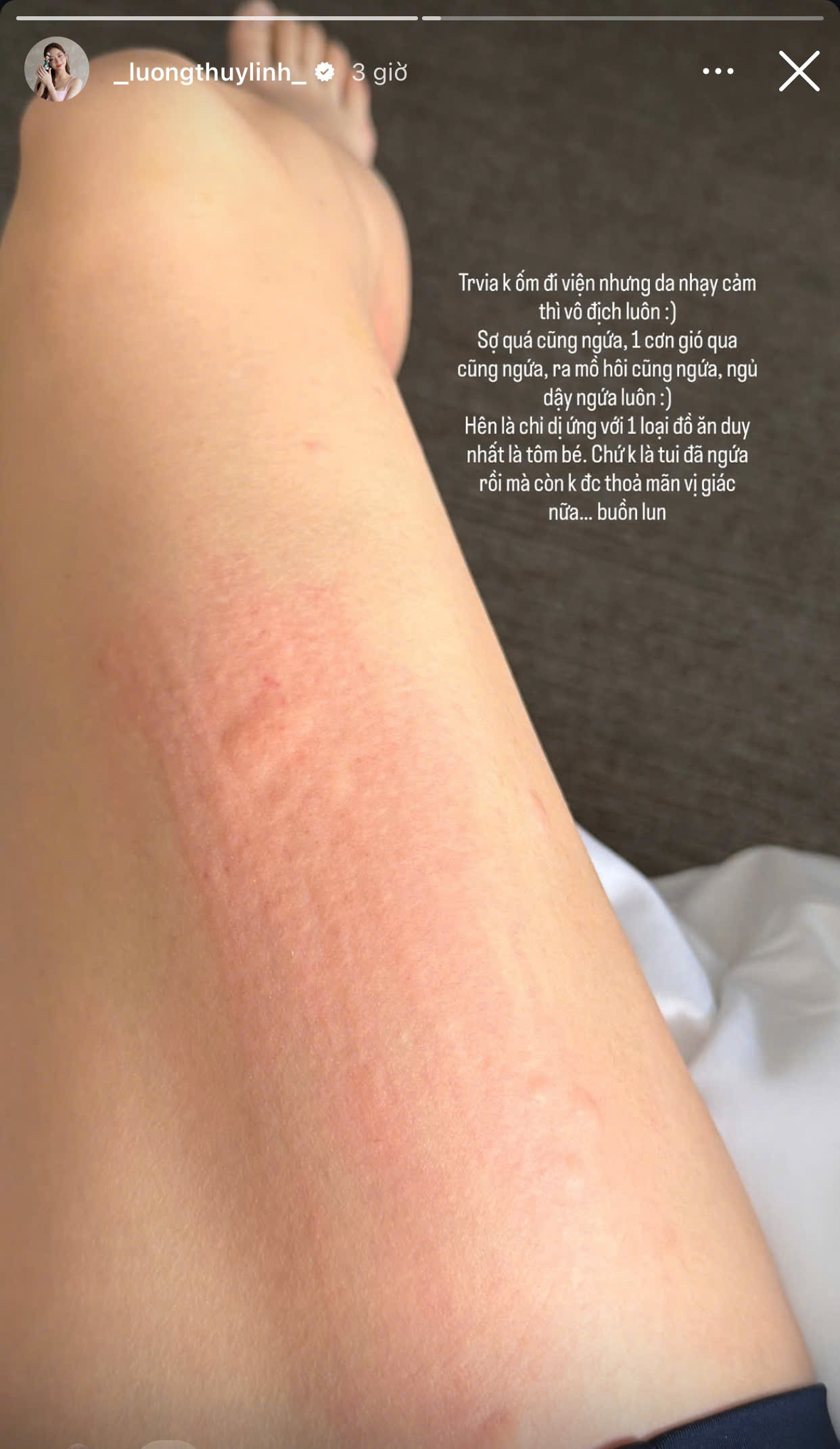 Hoa hậu Lương Thùy Linh lộ tình trạng bất ổn sau ồn ào cố tình tạo chiêu