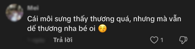 Hoa hậu Thanh Thủy bị hiểu lầm tiêm môi