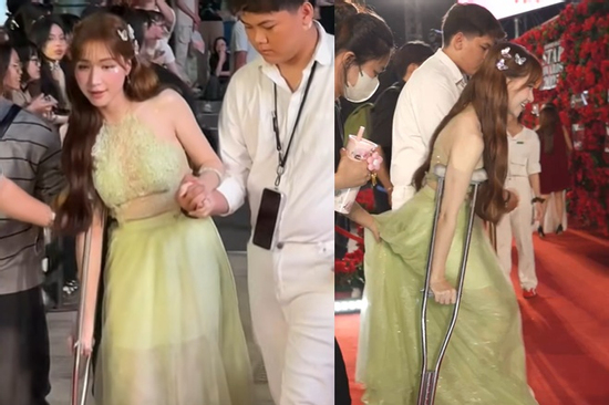 Hòa Minzy chống nạng đến sự kiện, xe lăn phải theo sau, chuyện gì đang xảy ra