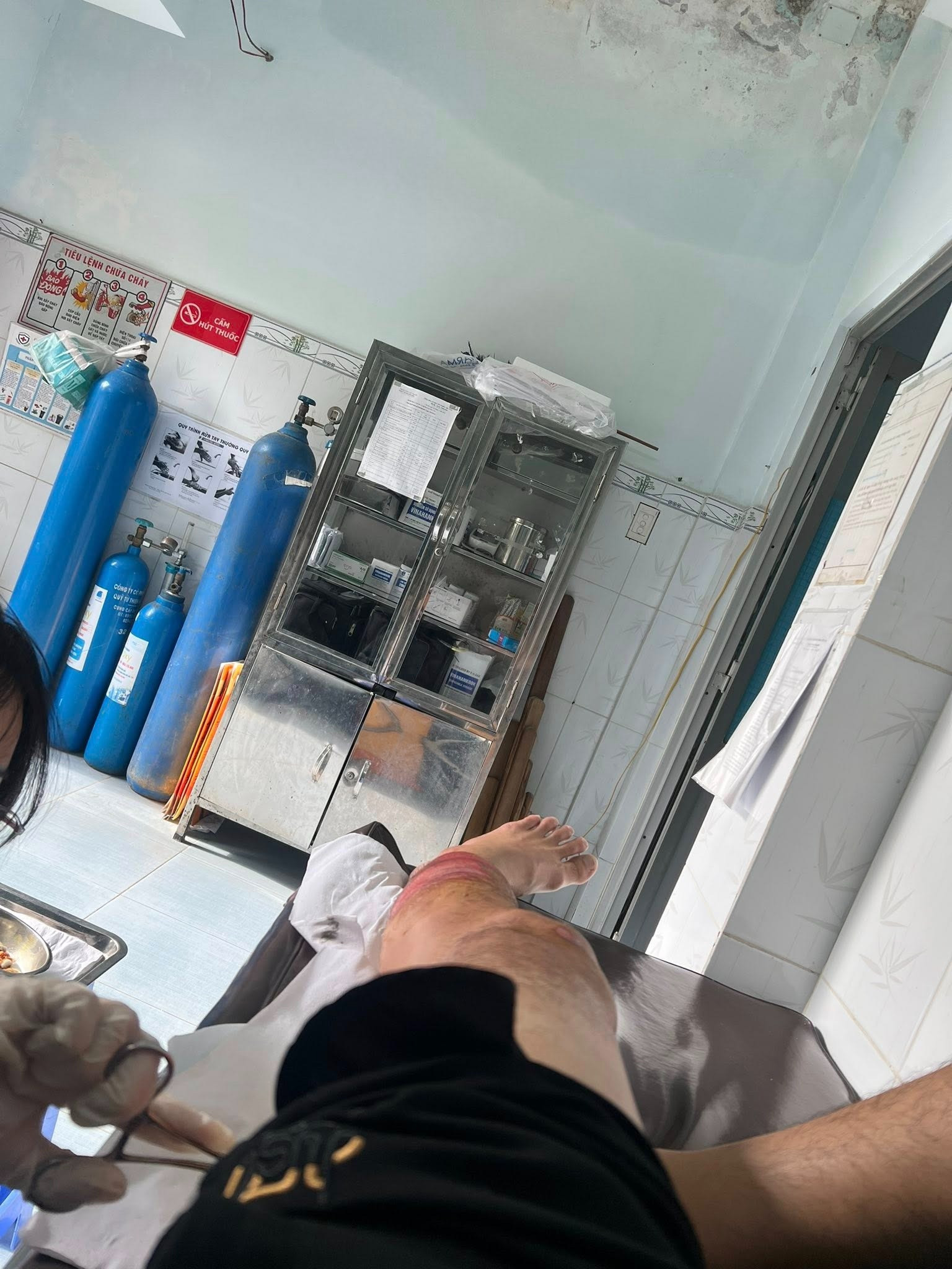 Nam diễn viên nổi tiếng Vbiz bị tai nạn kể lại khoảnh khắc kinh hoàng