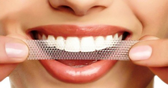 Rủi ro khi lạm dụng miếng dán trắng răng