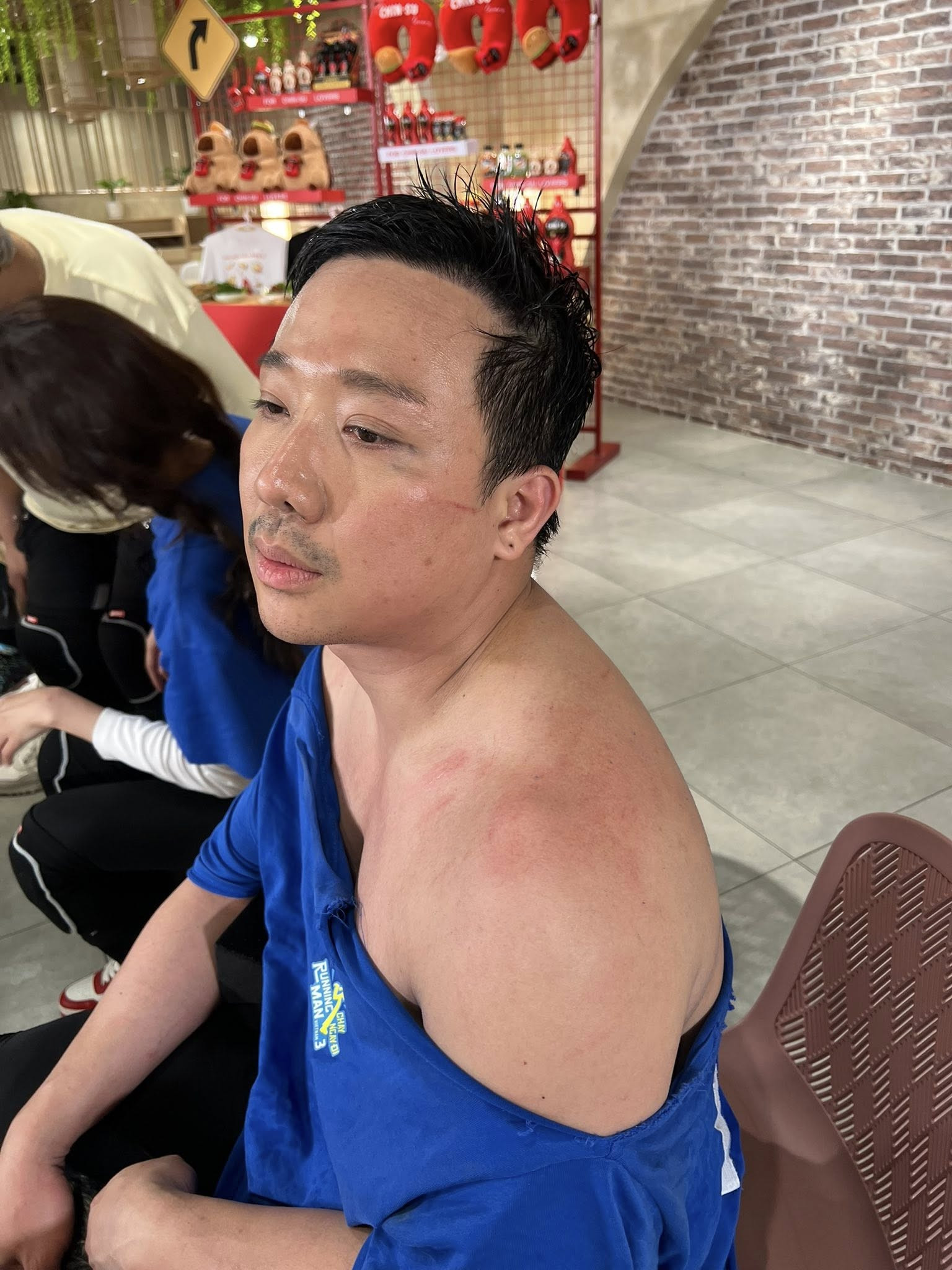 Giật mình hình ảnh tàn tạ không ra hình người của Trấn Thành