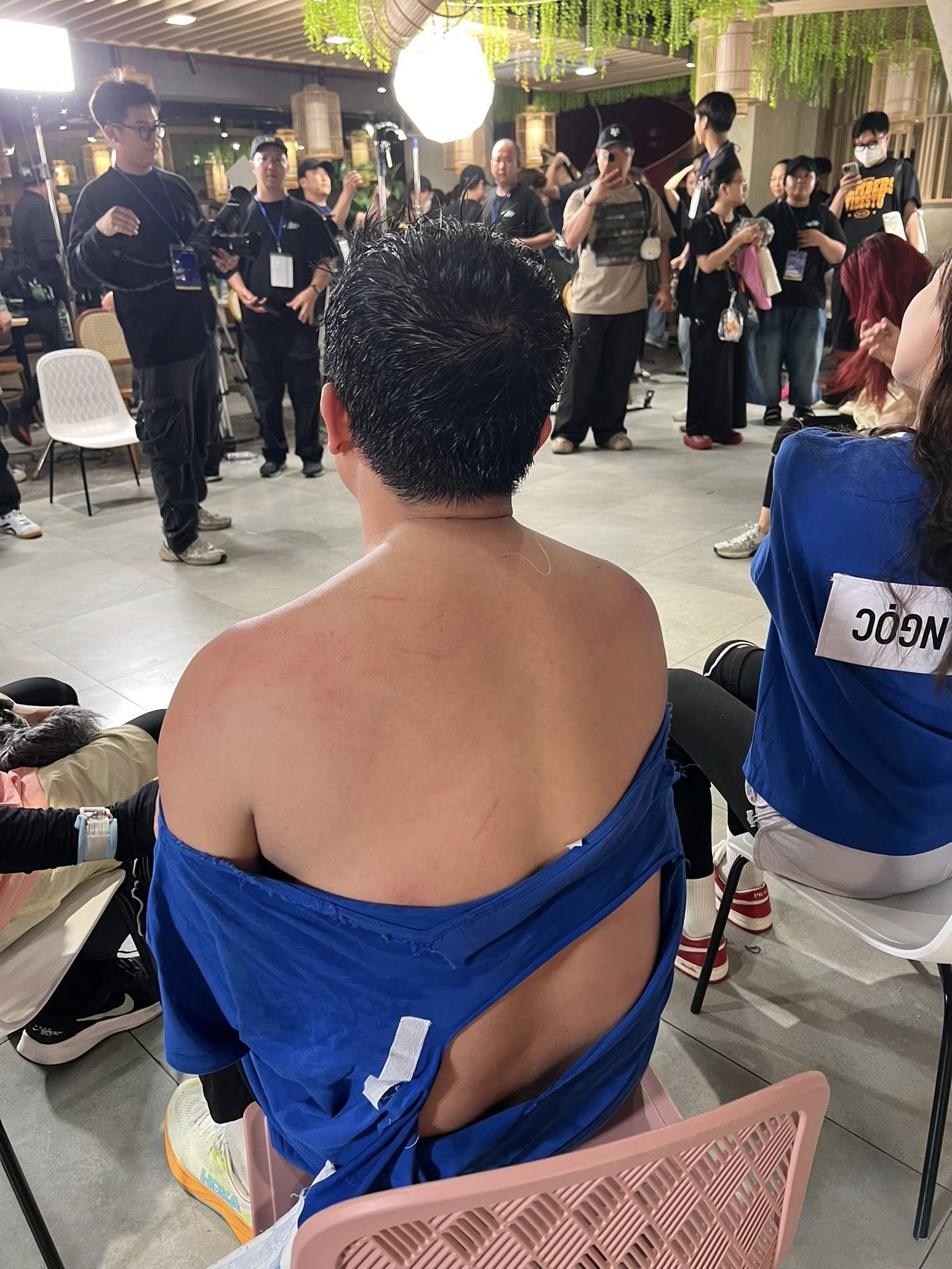 Giật mình hình ảnh bầm dập không ra hình người của Trấn Thành