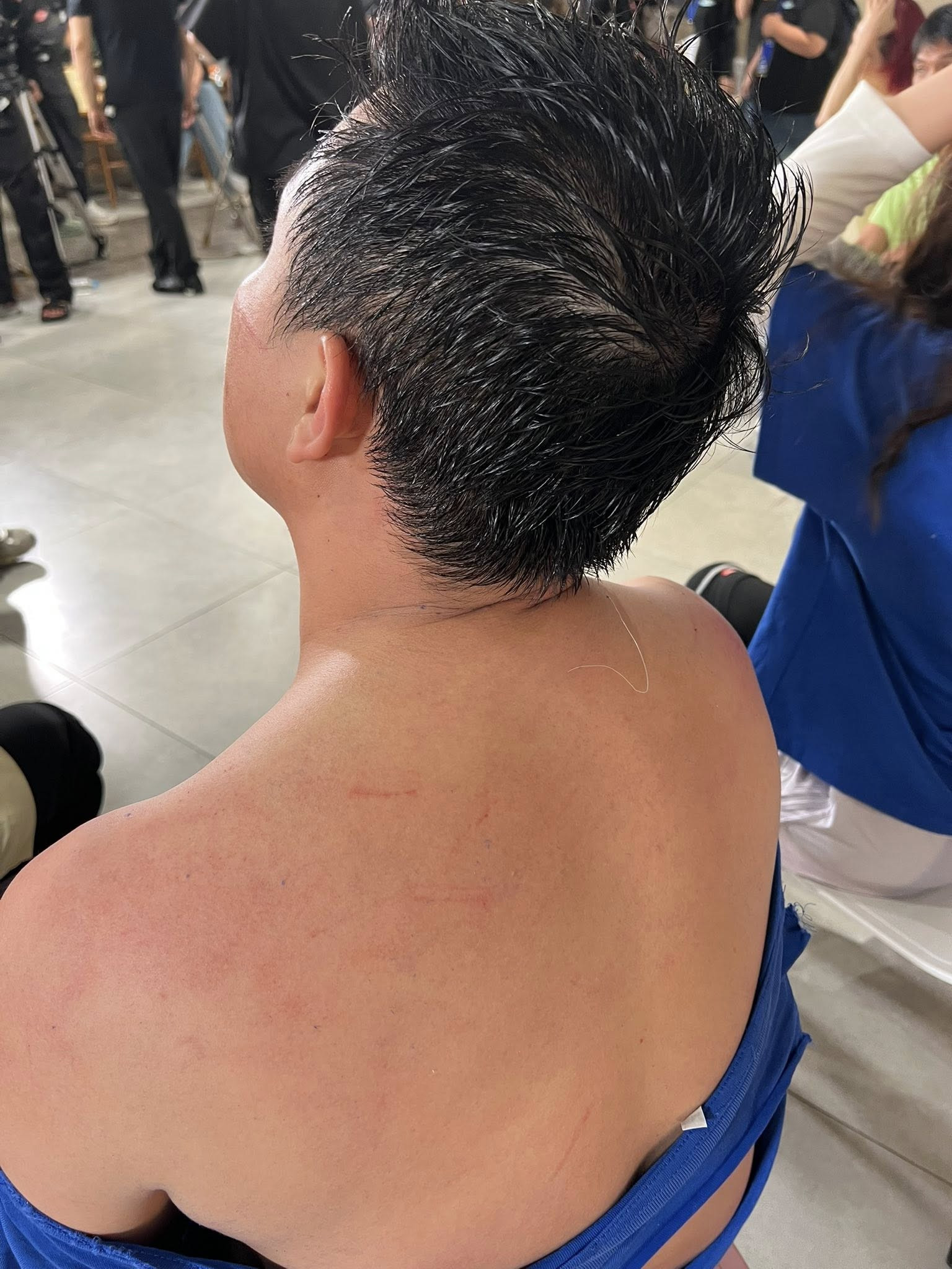 Giật mình hình ảnh bầm dập không ra hình người của Trấn Thành