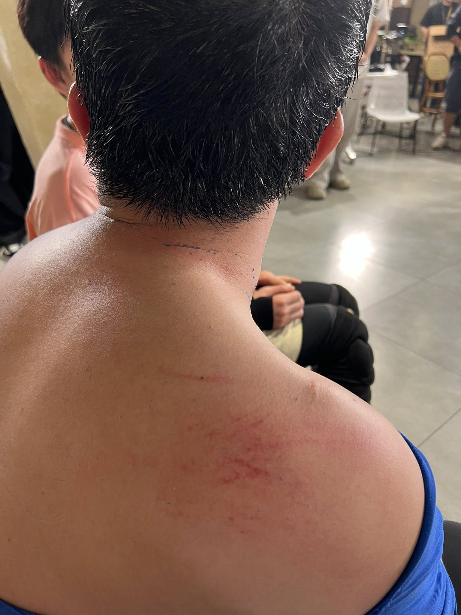 Giật mình hình ảnh bầm dập không ra hình người của Trấn Thành