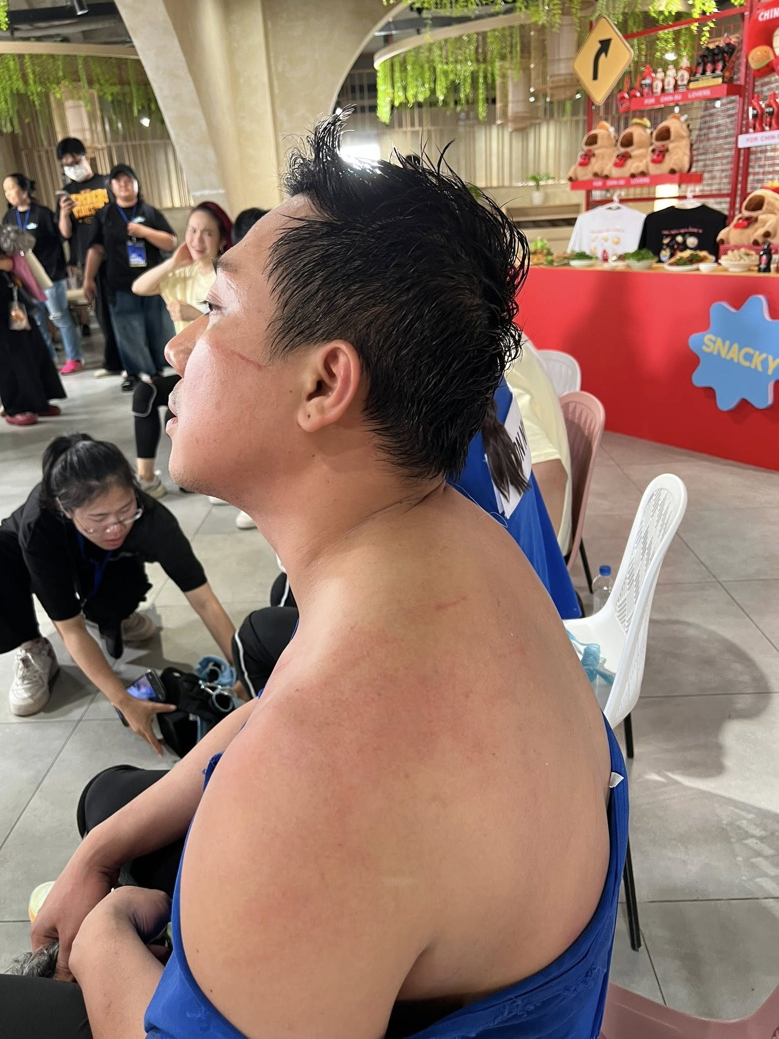 Giật mình hình ảnh bầm dập không ra hình người của Trấn Thành