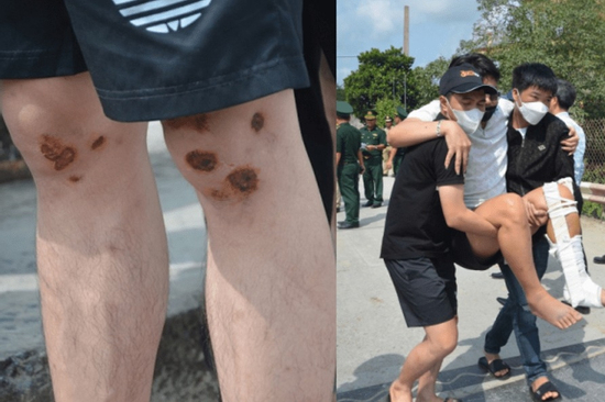 Nam thanh niên kể lại phút kinh hoàng khi làm việc ở Campuchia: chích điện bỏ đói, đòi 5.000 USD chuộc