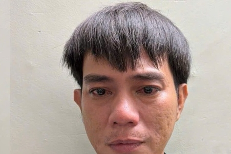 Người đàn ông mang thương tích đến Công an phường ở TPHCM trình báo