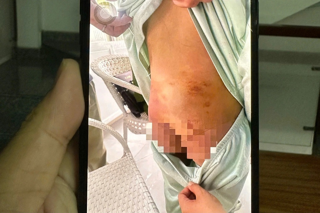 Vụ bé gái 9 tuổi bị bạo hành, ép nhúng lưỡi vào nước sôi: Bắt tạm giam mẹ ruột và người tình - Ảnh 2.