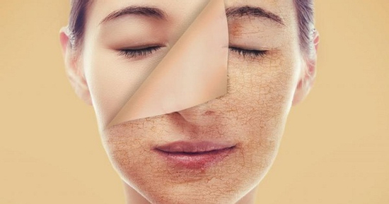 Cách chăm sóc da mùa đông phòng nứt nẻ