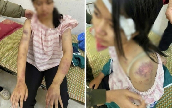 Hoàn cảnh éo le của bé gái 13 tuổi bị bà nội tra khảo, đánh đập