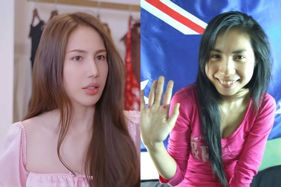 Thủy Tiên khác lạ không nhận ra, nghi mới can thiệp thẩm mỹ