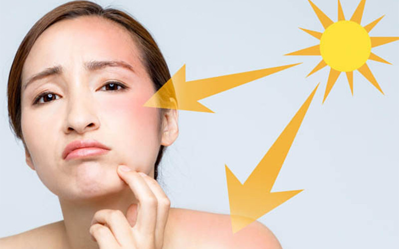 Đây là cách hấp thụ vitamin D mà không bị rám nắng - Ảnh 3.