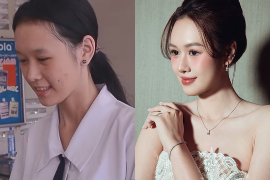 Không nhận ra bà xã Anh Đức trước khi can thiệp thẩm mỹ, body gầy nhẳng