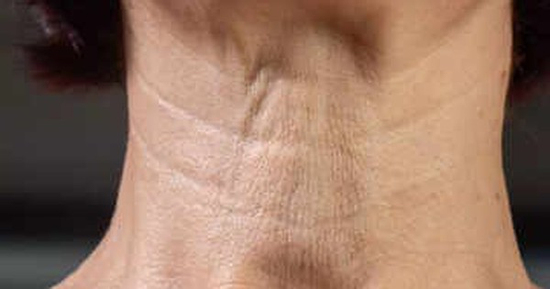 4 bài tập đơn giản xóa nếp nhăn, làm săn chắc vùng cổ tự nhiên tại nhà