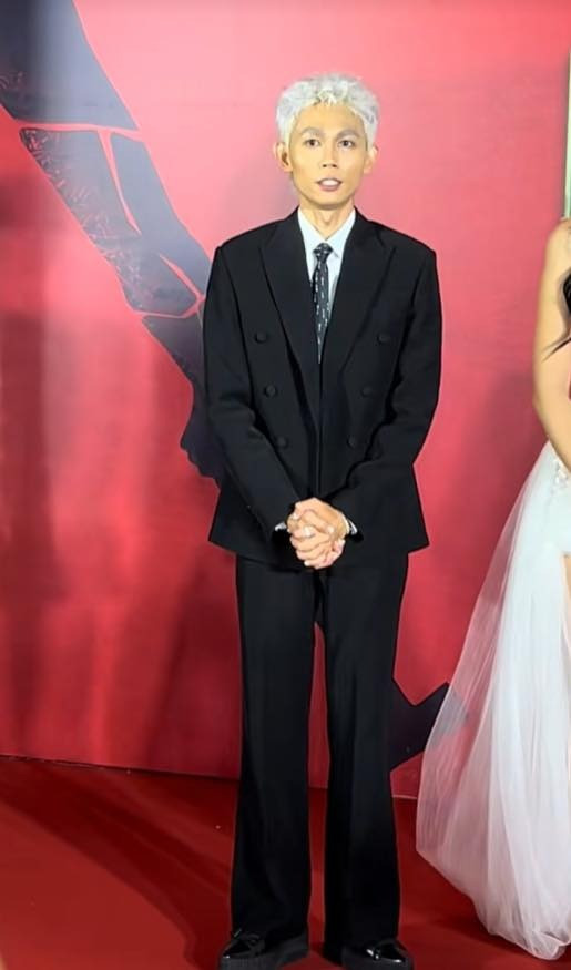 Nam diễn viên Vbiz gây shock với ngoại hình gầy rộc hốc hác không thể nhận ra