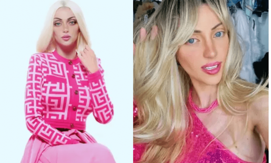 Người mẫu phẫu thuật 27 lần để giống 'búp bê sống' tử vong trong tình trạng bất thường tại nhà riêng