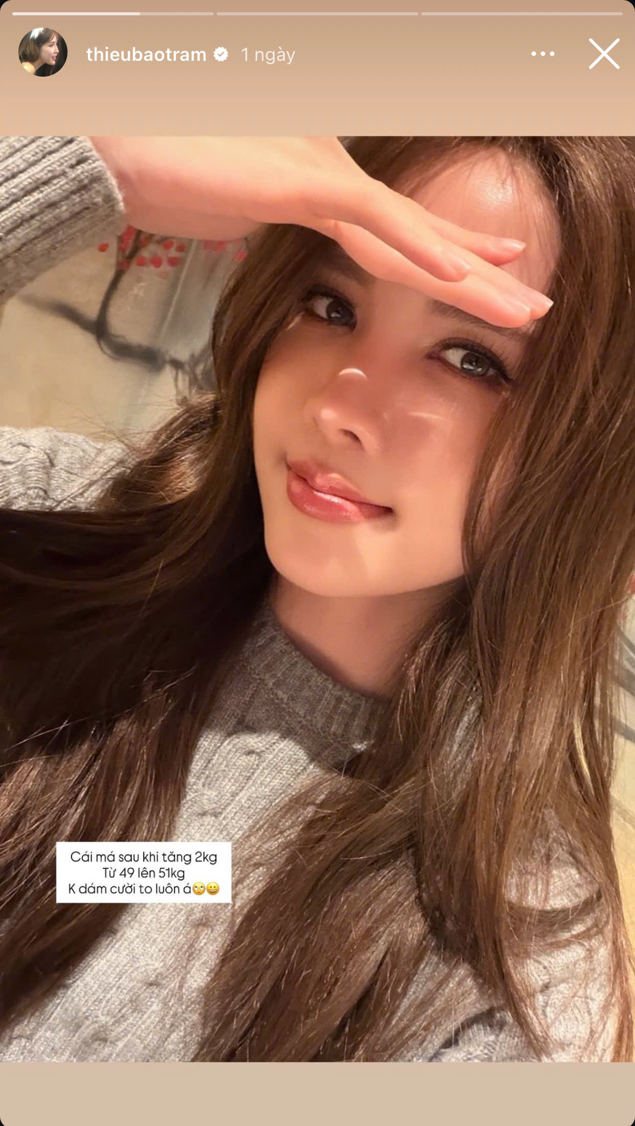 Nguyên do thực sự đằng sau gương mặt sưng phồng đơ như cây cơ của Thiều Bảo Trâm