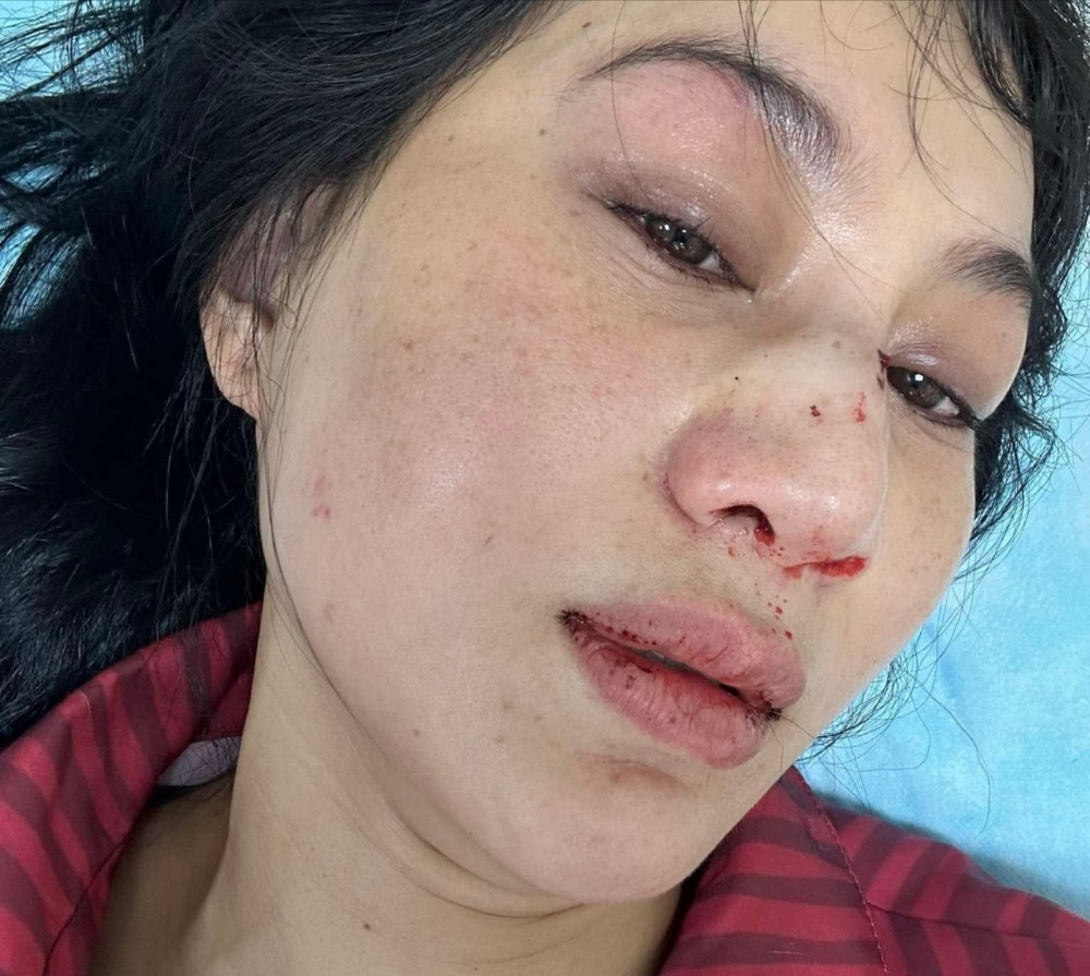 2 diễn viên tên Ngọc Ánh của Hương Ga người bị bắt người bị hành hung