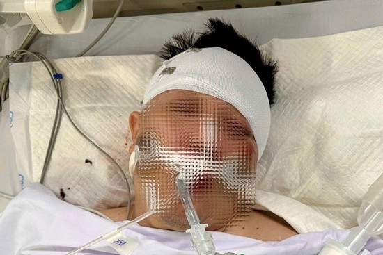 Tông trúng chó chạy rông trên đường, nam thanh niên đi xe máy nguy kịch