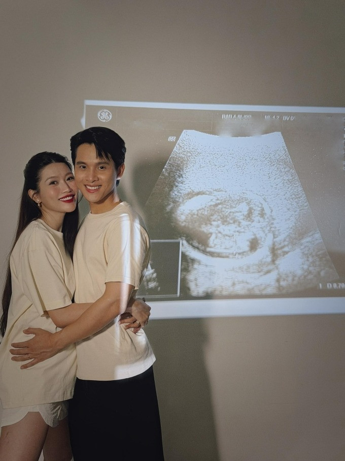 Phản ứng ông xã Á hậu Quỳnh Châu khi biết tin vợ mang con đầu lòng