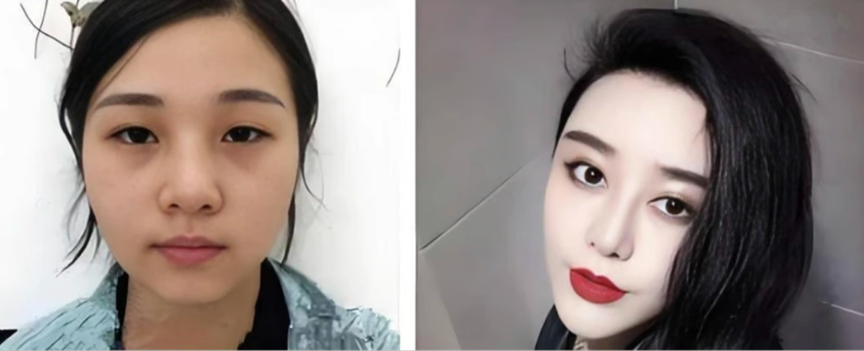 Cô gái chi gần 30 tỷ đồng để sở hữu gương mặt giống minh tinh Phạm Băng Băng - Ảnh 2