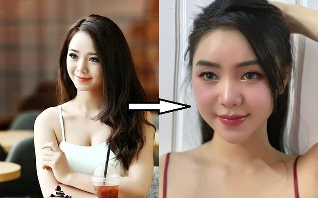 Quỳnh Kool công khai can thiệp thẩm mỹ