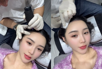 Quỳnh Kool gây tranh cãi khi công khai can thiệp thẩm mỹ