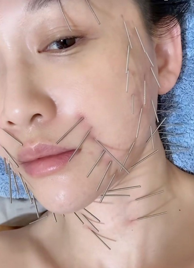 Hình ảnh bóc trần nhan sắc thật của Trần Kiều Ân có trẻ trung như tin đồn