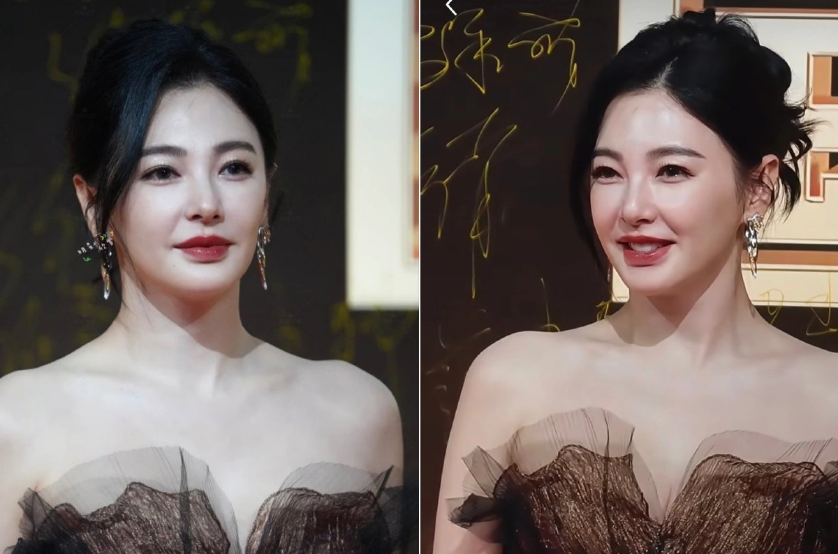 Trương Vũ Kỳ gây xôn xao vì gương mặt nhiều thay đổi, được nhận xét 'rất kém tự nhiên' - Ảnh 1