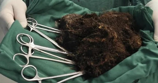 Người phụ nữ bụng 