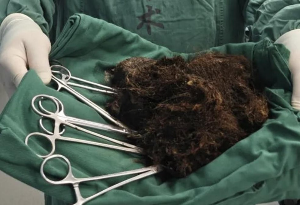 Người phụ nữ bụng