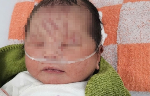 Bé sơ sinh bị vùi lấp ở Gia Lai chính thức được nhận nuôi