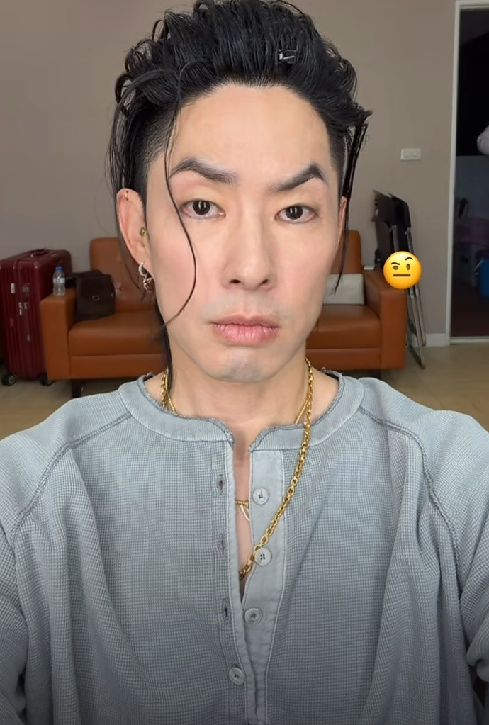 Ngoại hình gầy rộc hốc hác khó tin của tài tử nhóm F4 Vườn Sao Băng