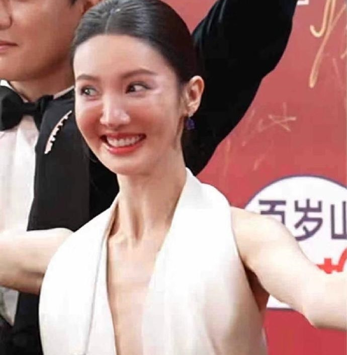 Nữ diễn viên nổi tiếng để lộ gương mặt ngày càng kì lạ biến dạng do thẩm mỹ