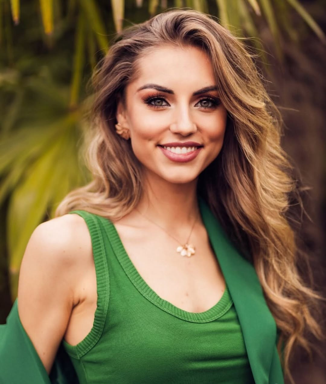 Tân Hoa hậu Bỉ được khen ảnh 5