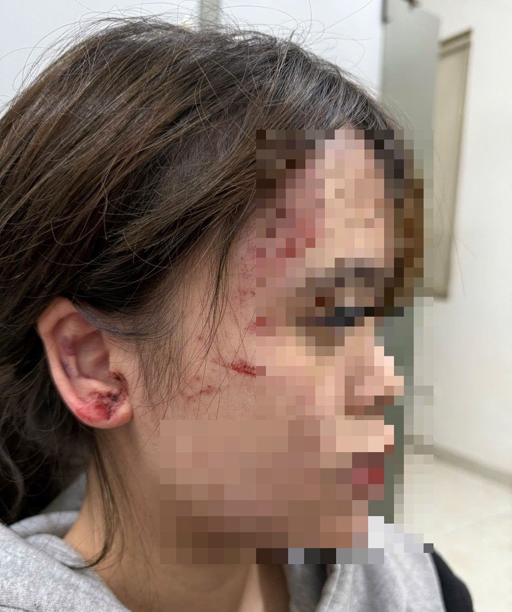 cfc23ee7 38e0 4bac ab0f 71c863dce88a.jpg