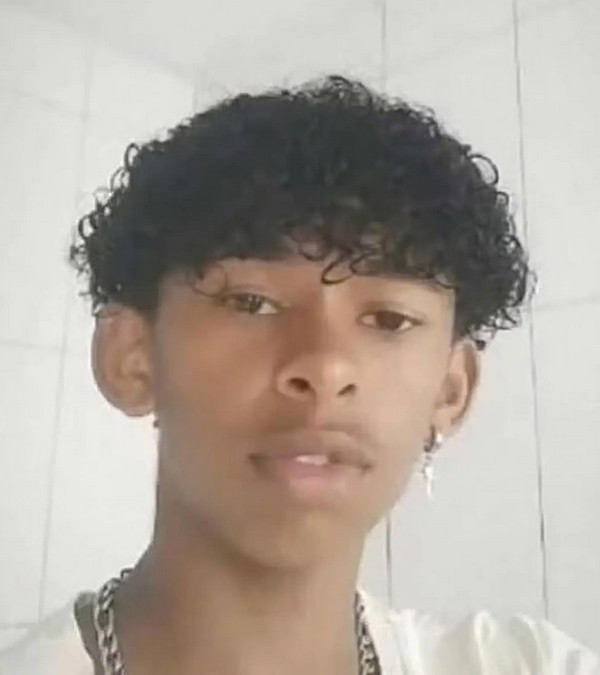 Brazil: Học theo mạng, nam sinh đưa con bướm vào người gây hậu quả nghiêm trọng ảnh 1