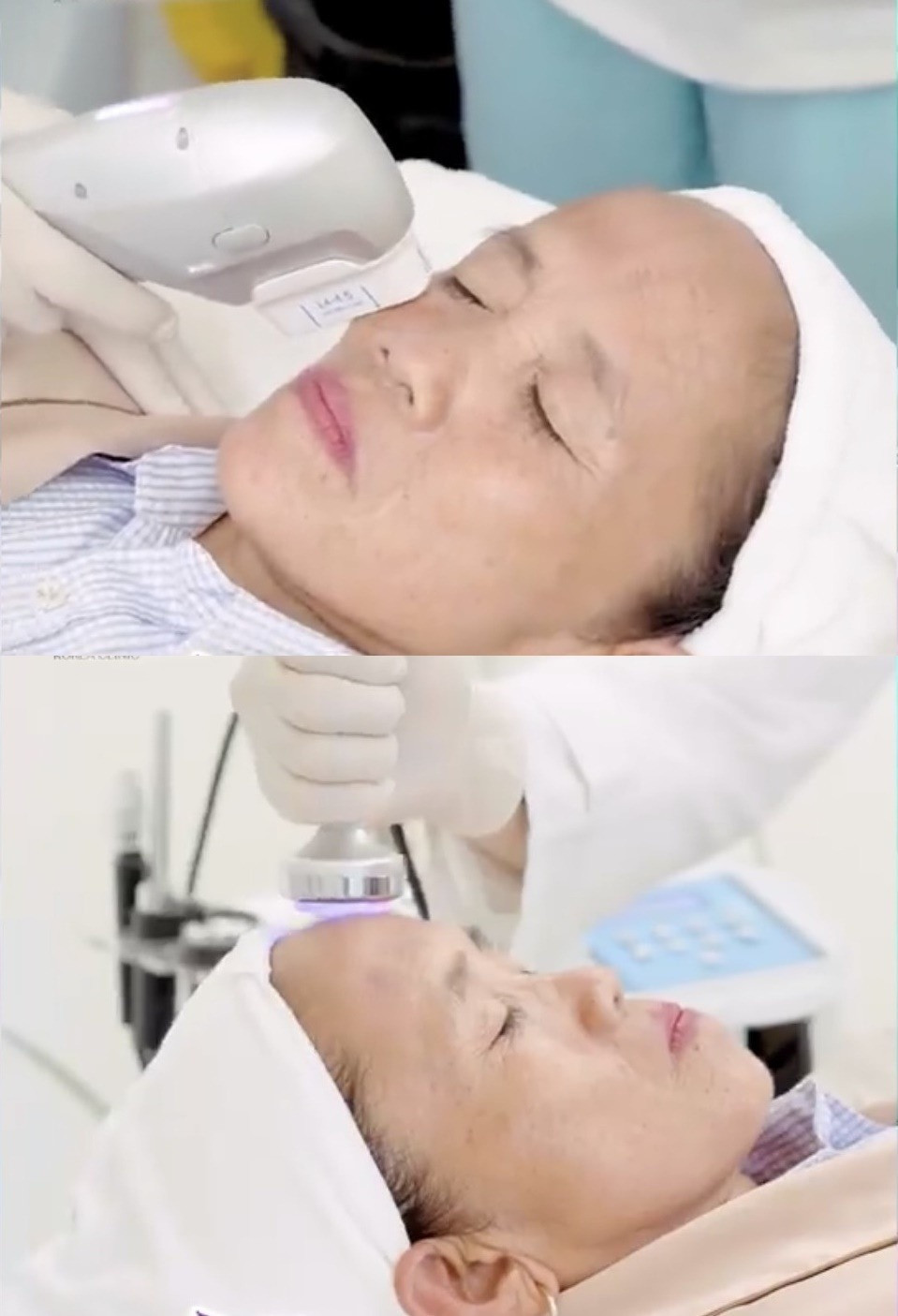 Giật mình diện mạo hiện tại bà Tân Vlog sau 3 năm thẩm mỹ trùng tu nhan sắc