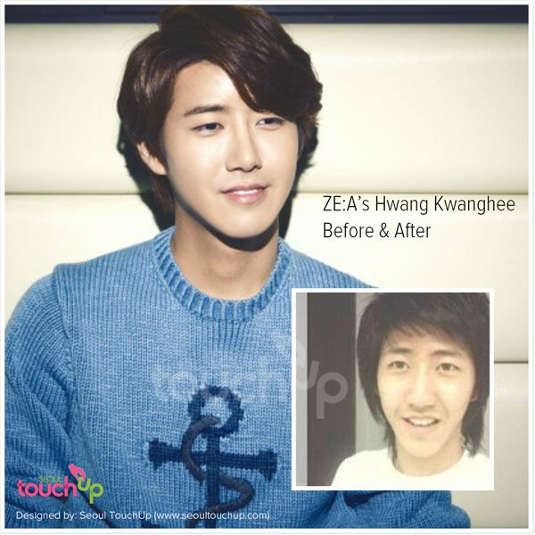 kwanghee beforeafter