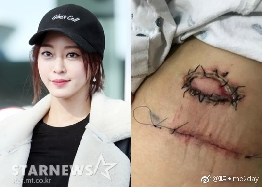 fs 15244753924352009654890