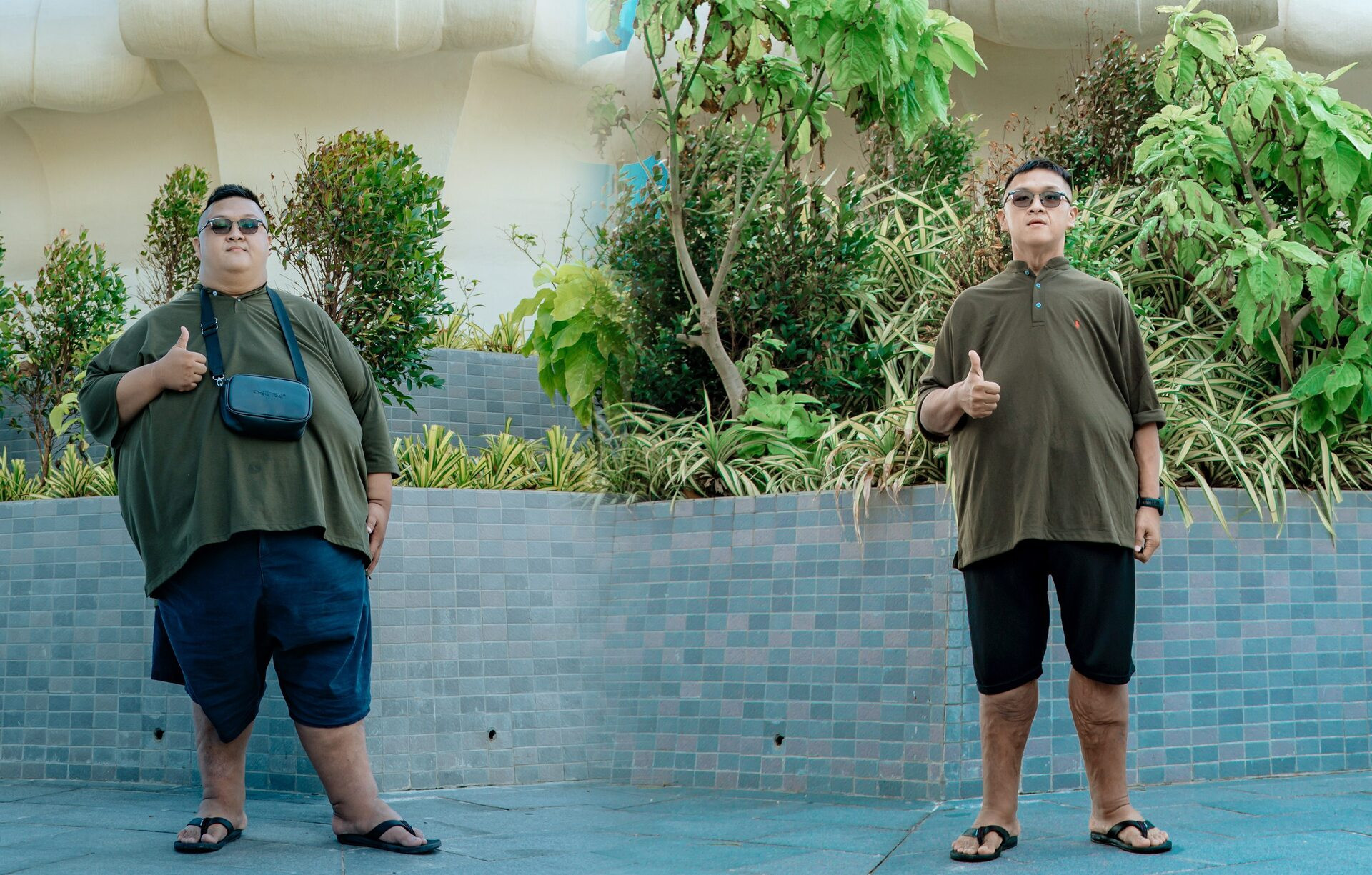 Chàng trai giảm 132kg trong 13 tháng, chuẩn bị cuộc đại phẫu cắt da thừa - 3