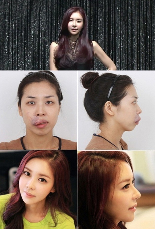 Chương trình phẫu thuật thẩm mỹ gây sốc ảnh 1