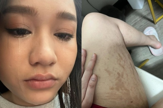 Trúc Anh Mắt Biếc thừa nhận chạm mốc kỉ lục 81kg