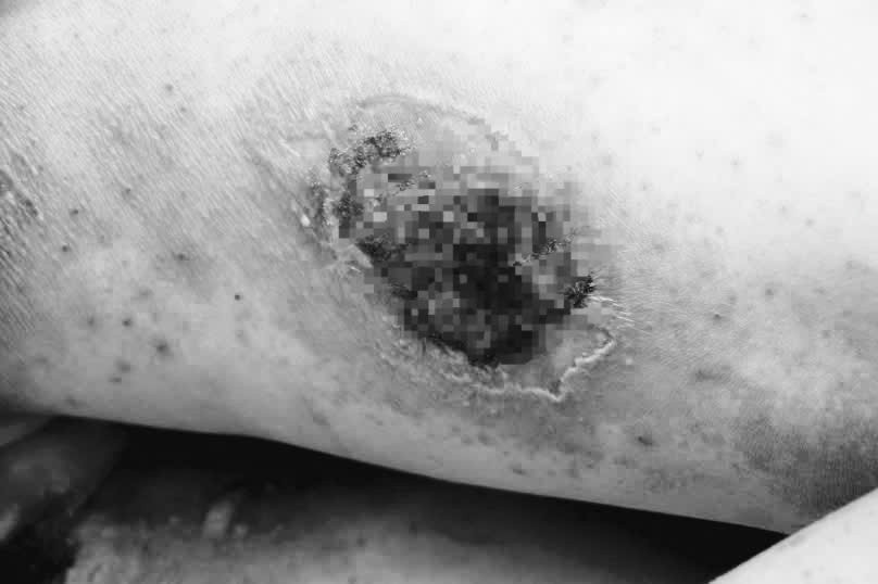 kien ba khoang da lieu.jpg